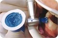 Паста полировочная Cleanic, набор: унидозы (по 2 г) 200 шт, 3 чашечки 17273 - фото 32884